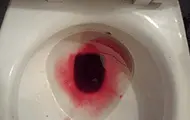Sinais na urina